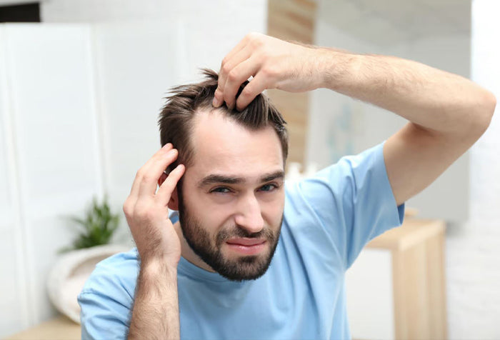 Man examining his hair line in the mirror.