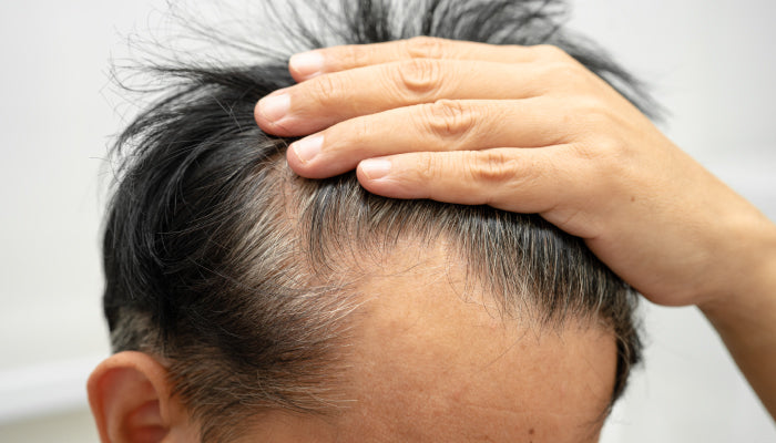 What Vitamins Are Good for Hair Growth?