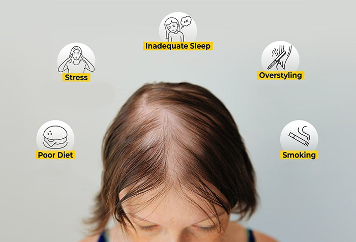 Woman with balding hair surrounded by lifestyle choices that cause hair loss.