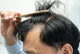 Balding man examining his hair line with a comb.