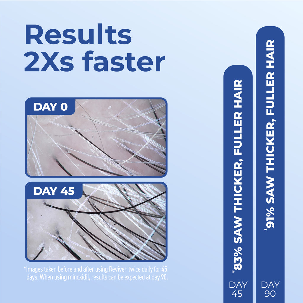 Results 2 times faster with day 0 and day 45 images.