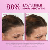 88% saw visible hair growth with before and after images of a woman.