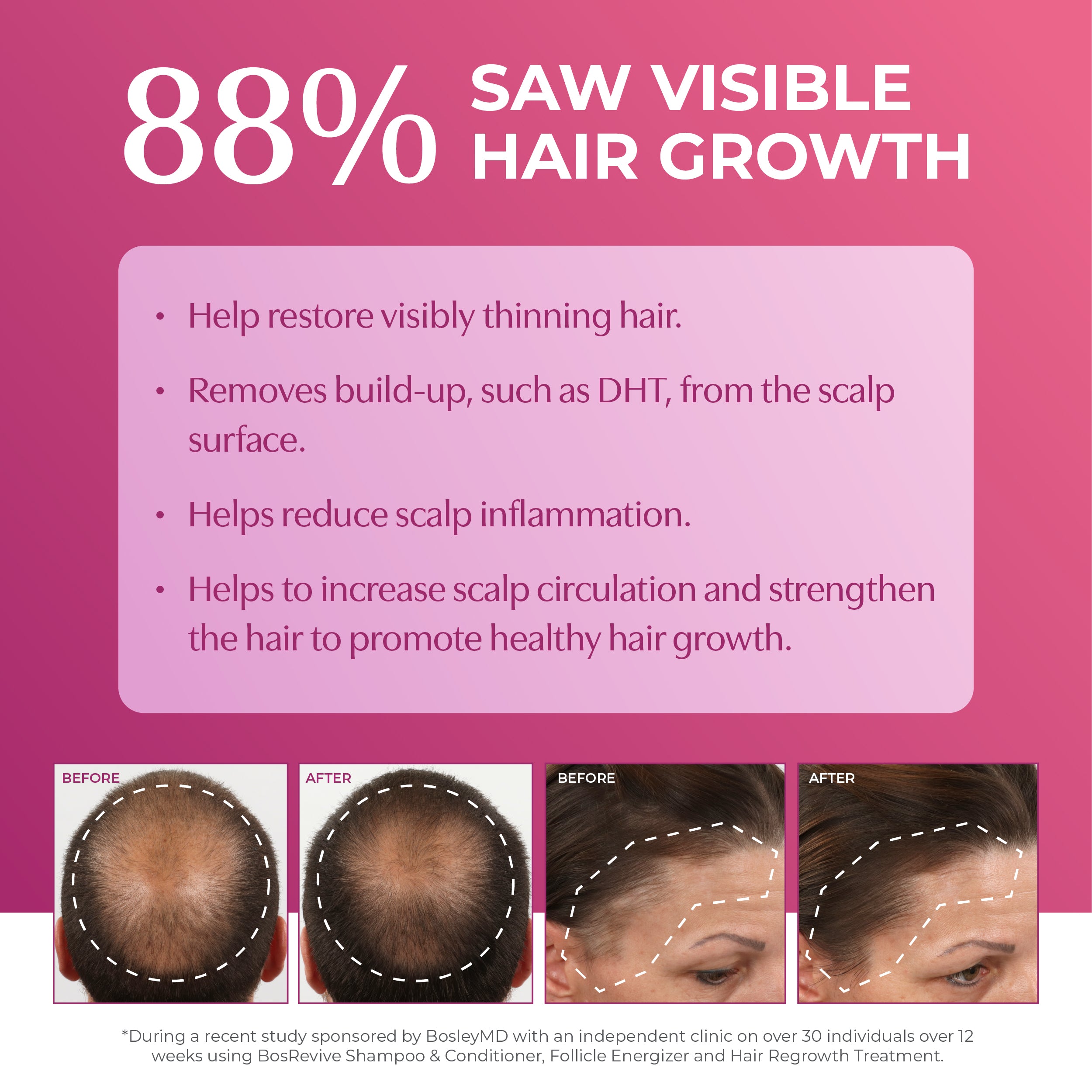 88% saw visible hair growth. Before and after images.