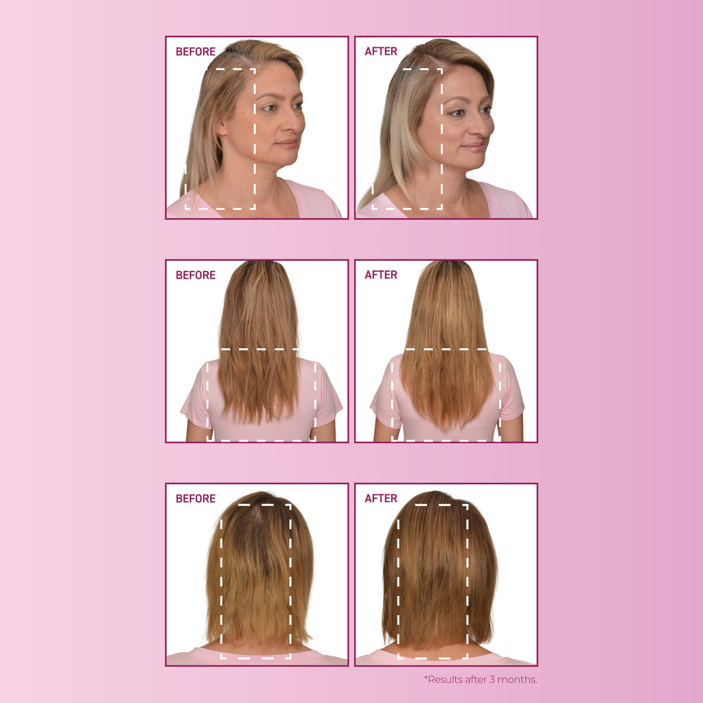 Before and after images of female hair growth.