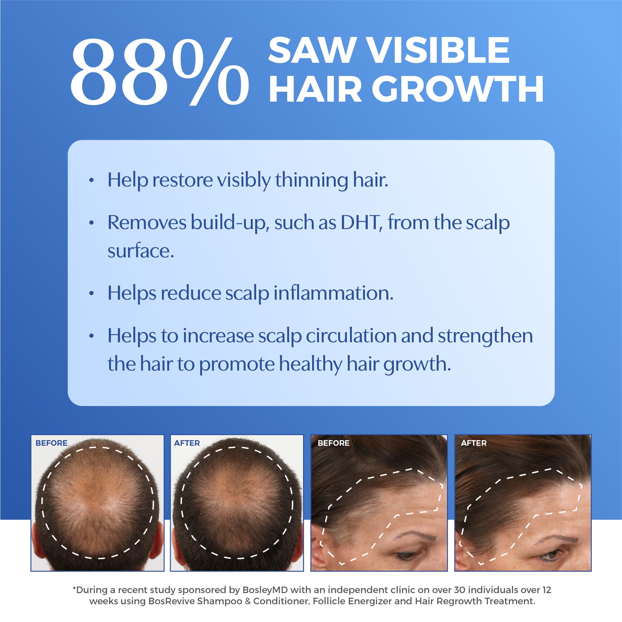 88% saw visible hair growth with before and after images.