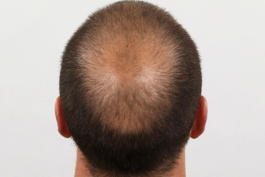 Before photo — Men