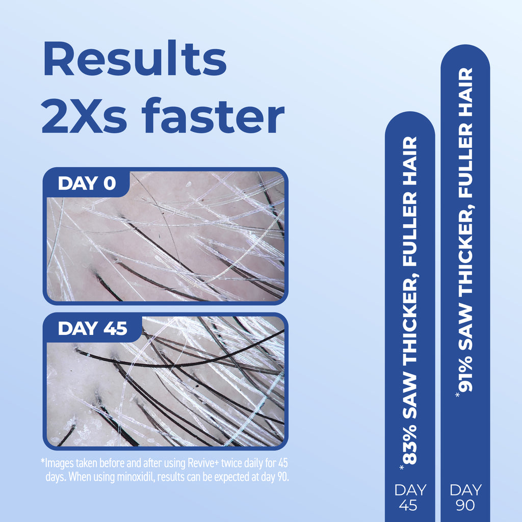 Results 2 times faster with Day 0 and Day 45 images.
