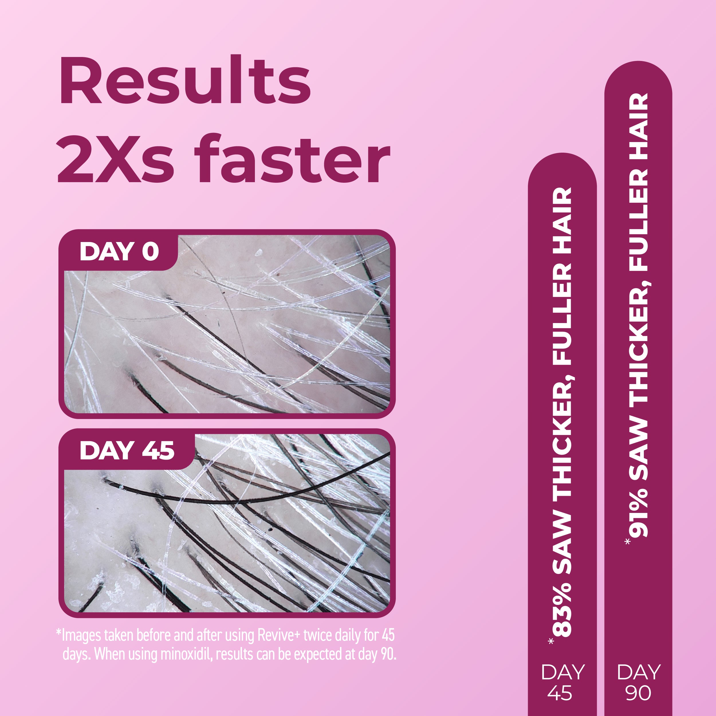 Results 2 Times Faster with Day 0 and Day 45 images.